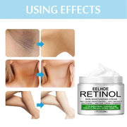 Body Whitening Cream for even-toned complexion and dark spot reduction.