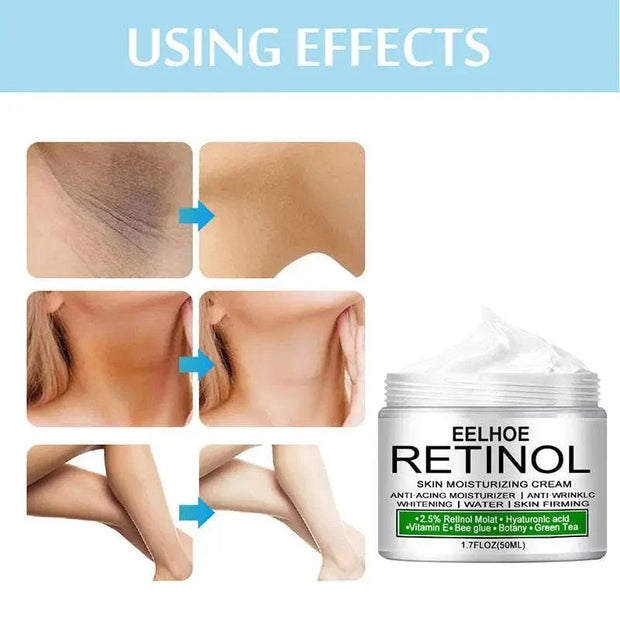 Body Whitening Cream for even-toned complexion and dark spot reduction.