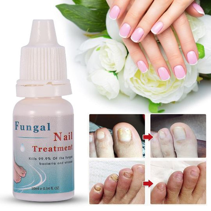 Moisturizing Fungal Nail Treatment